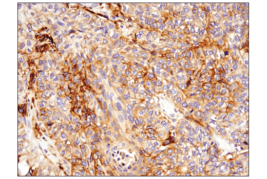 Immunohistochemistry Image 4: Podoplanin (LpMab-12) Mouse mAb