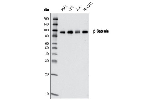 Western Blotting Image 1: β-Catenin (L87A12) Mouse mAb