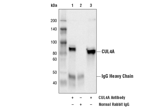  Image 13: Ubiquitin E3 Ligase Complex Antibody Sampler Kit