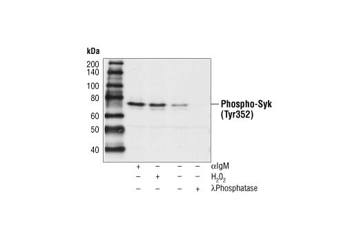  Image 10: Phospho-Syk Antibody Sampler Kit