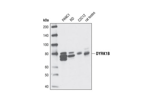 Western Blotting Image 1: DYRK1B Antibody