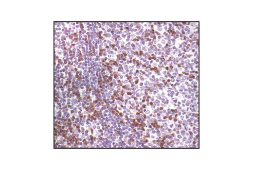 Immunohistochemistry Image 2: Zap-70 (99F2) Rabbit mAb