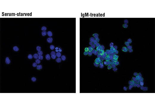 Immunofluorescence Image 1: Phospho-Syk (Tyr525/526) (C87C1) Rabbit mAb