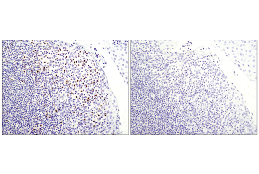 Immunohistochemistry Image 3: T-bet/TBX21 (D6N8B) XP® Rabbit mAb (BSA and Azide Free)
