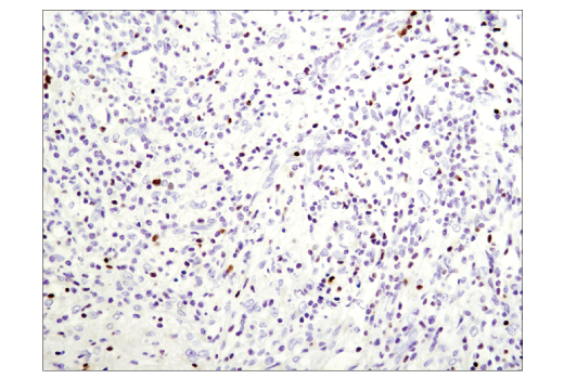 Immunohistochemistry Image 2: T-bet/TBX21 (D6N8B) XP® Rabbit mAb (BSA and Azide Free)