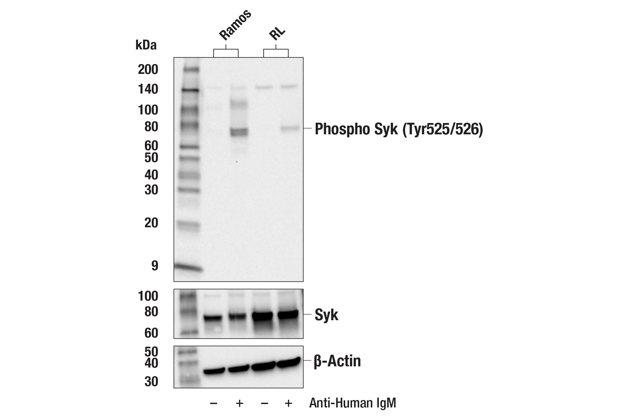 Western Blotting Image 1: Phospho-Syk (Tyr525/526) Antibody