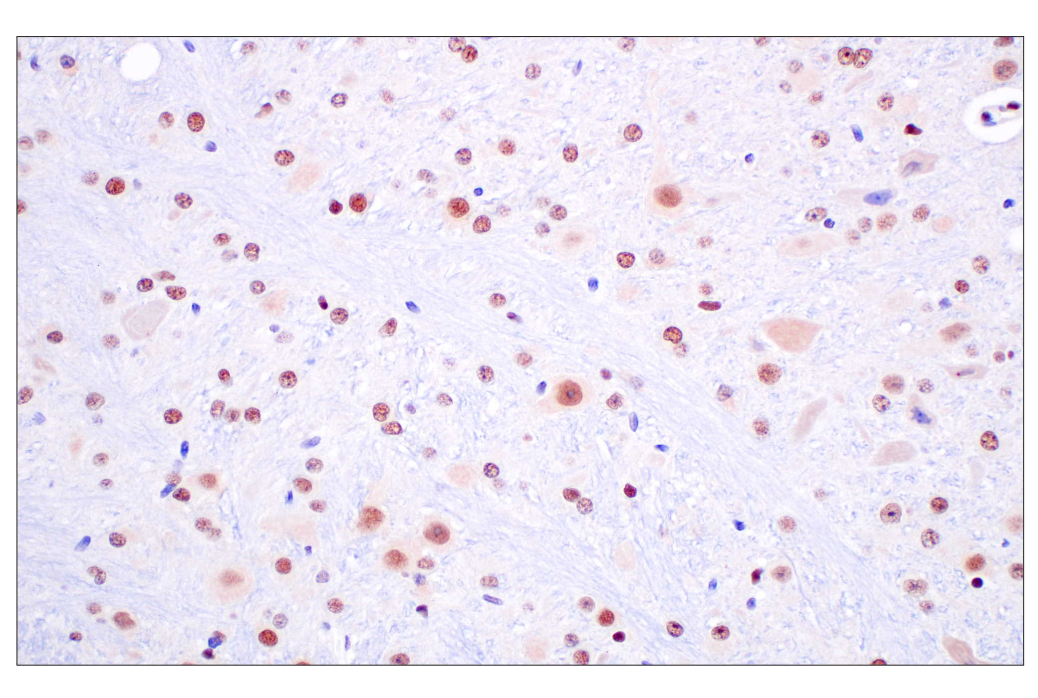 Immunohistochemistry Image 12: FKBP5 (F1G3I) Rabbit mAb