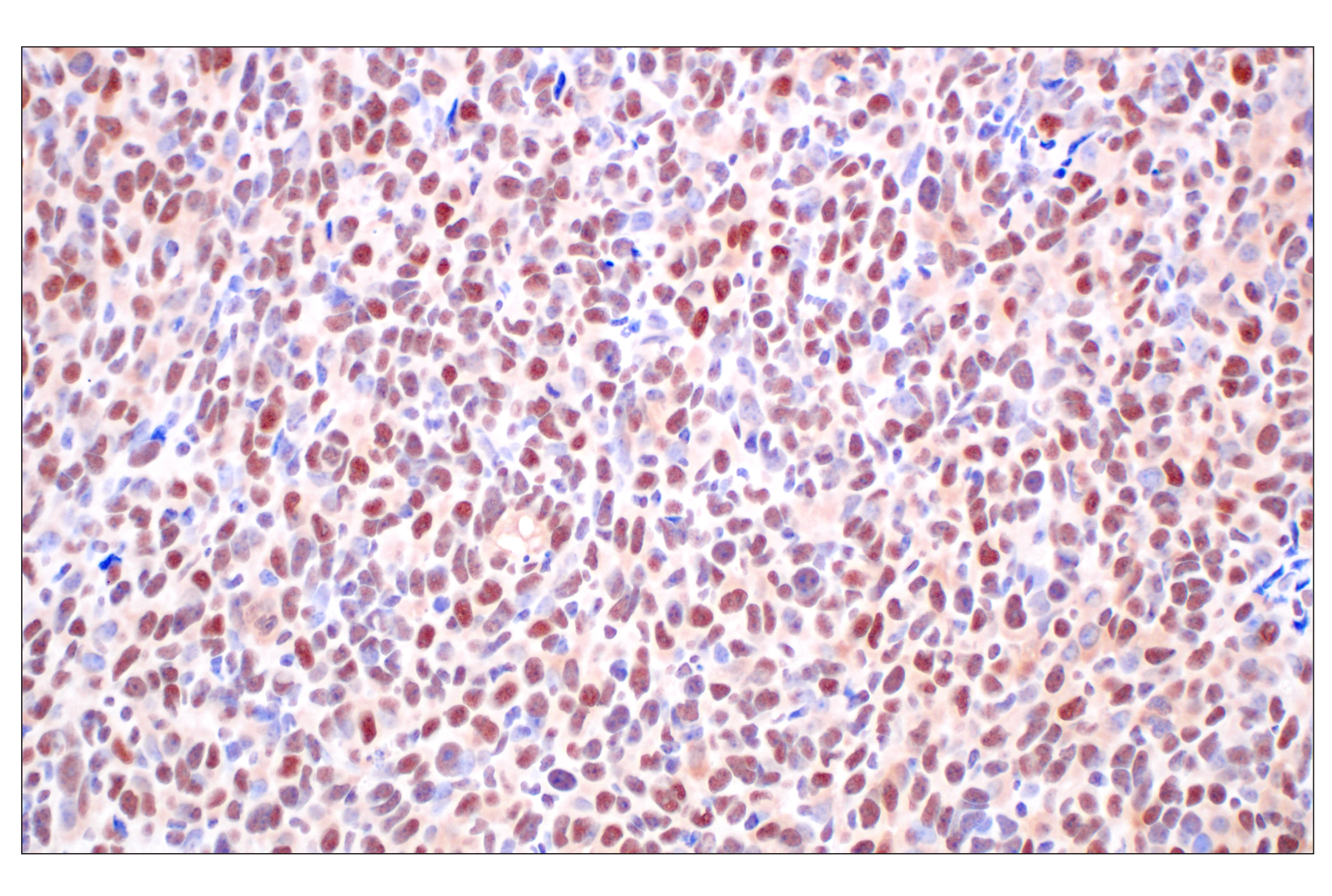 Immunohistochemistry Image 6: FKBP5 (F1G3I) Rabbit mAb