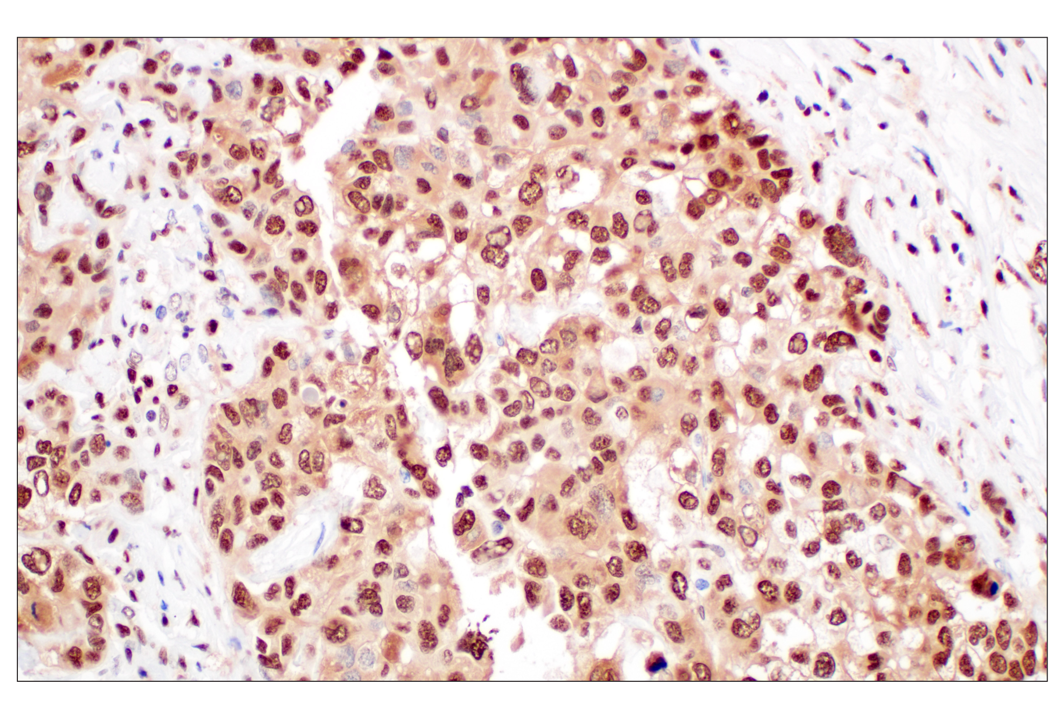 Immunohistochemistry Image 2: FKBP5 (F1G3I) Rabbit mAb