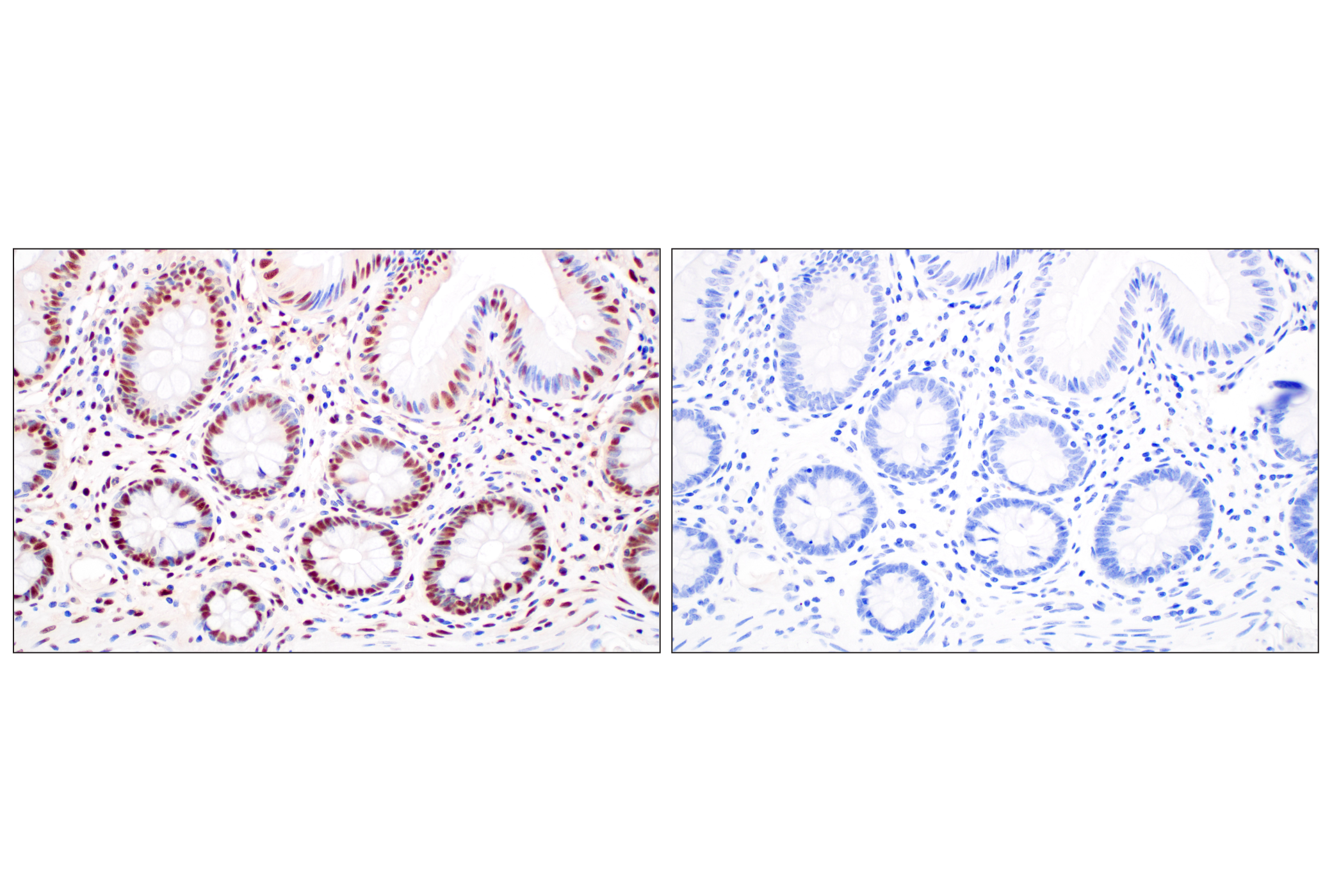 Immunohistochemistry Image 16: FKBP5 (F1G3I) Rabbit mAb