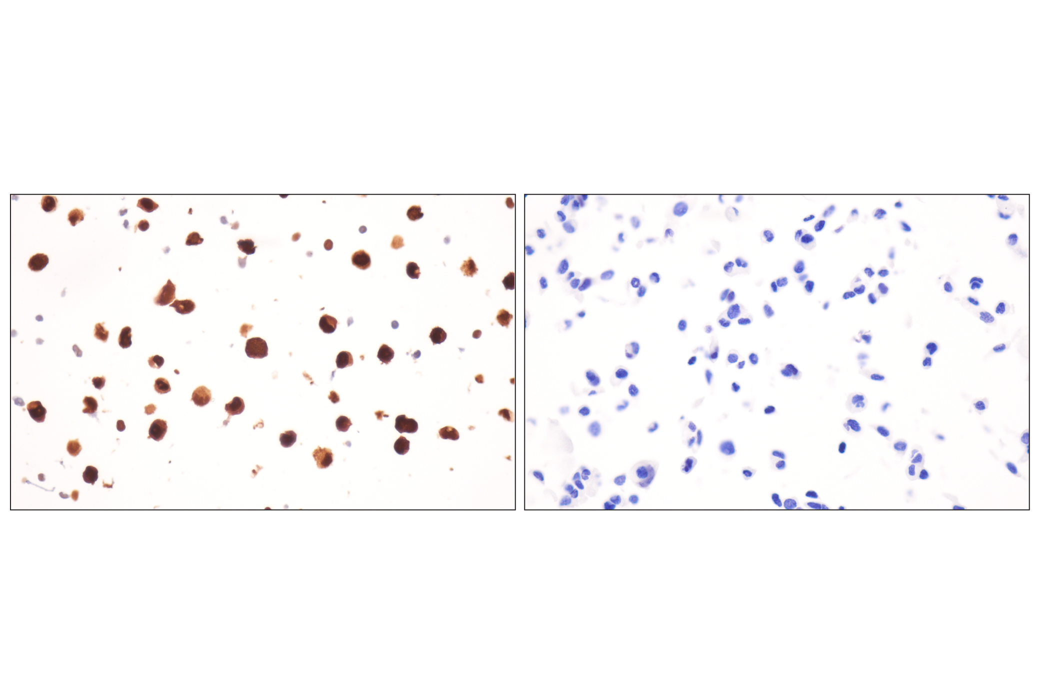 Immunohistochemistry Image 17: FKBP5 (F1G3I) Rabbit mAb