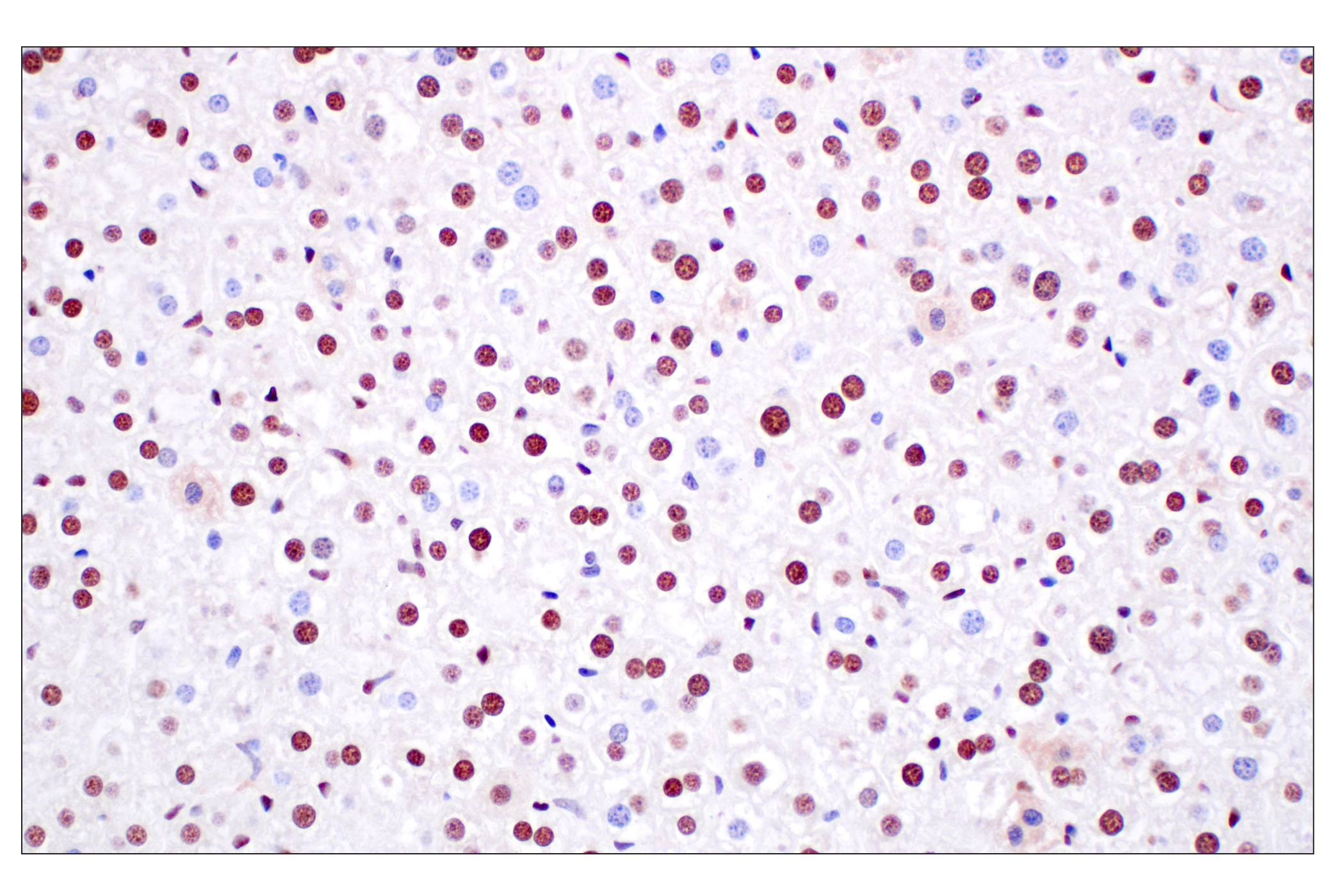 Immunohistochemistry Image 9: FKBP5 (F1G3I) Rabbit mAb
