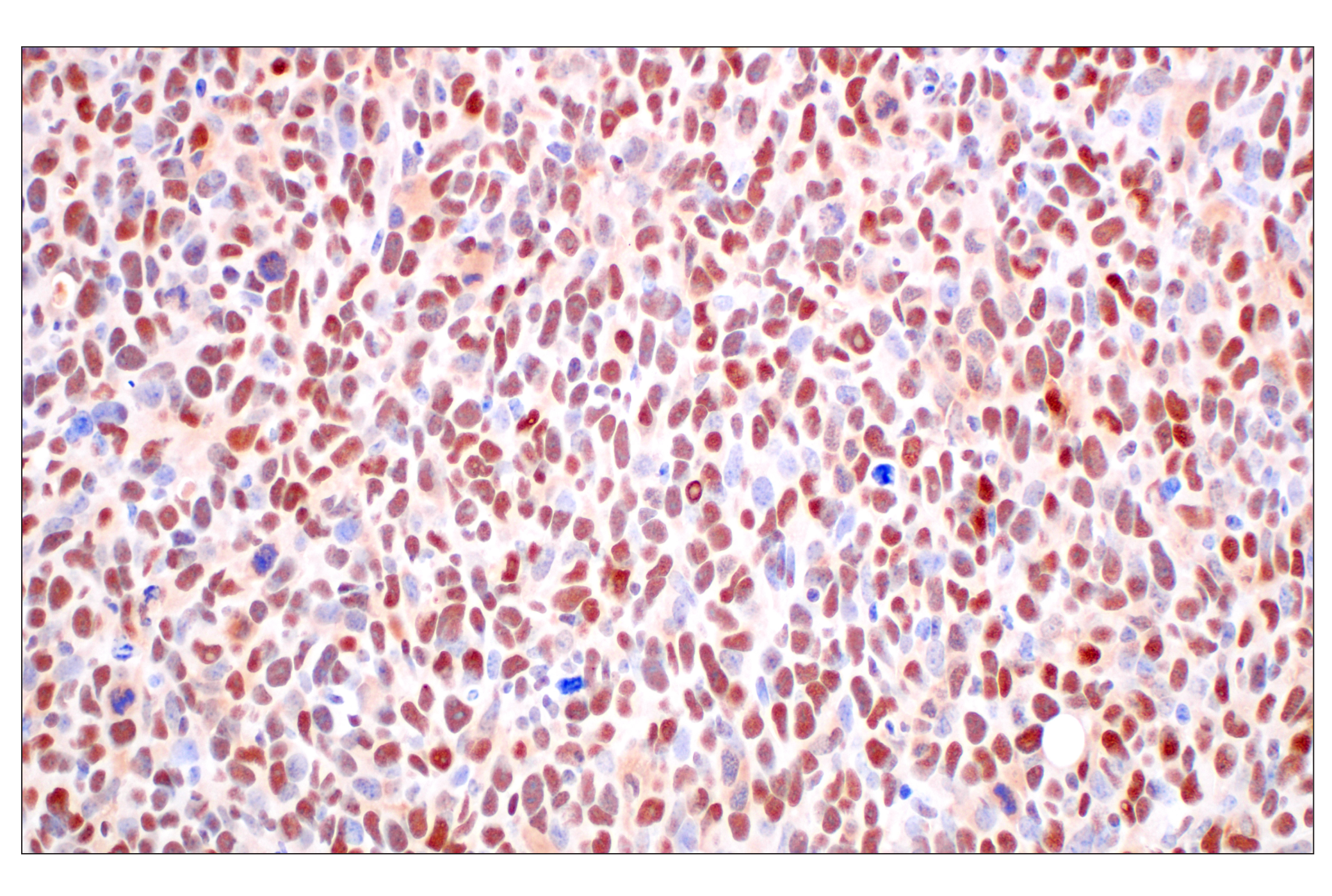 Immunohistochemistry Image 7: FKBP5 (F1G3I) Rabbit mAb