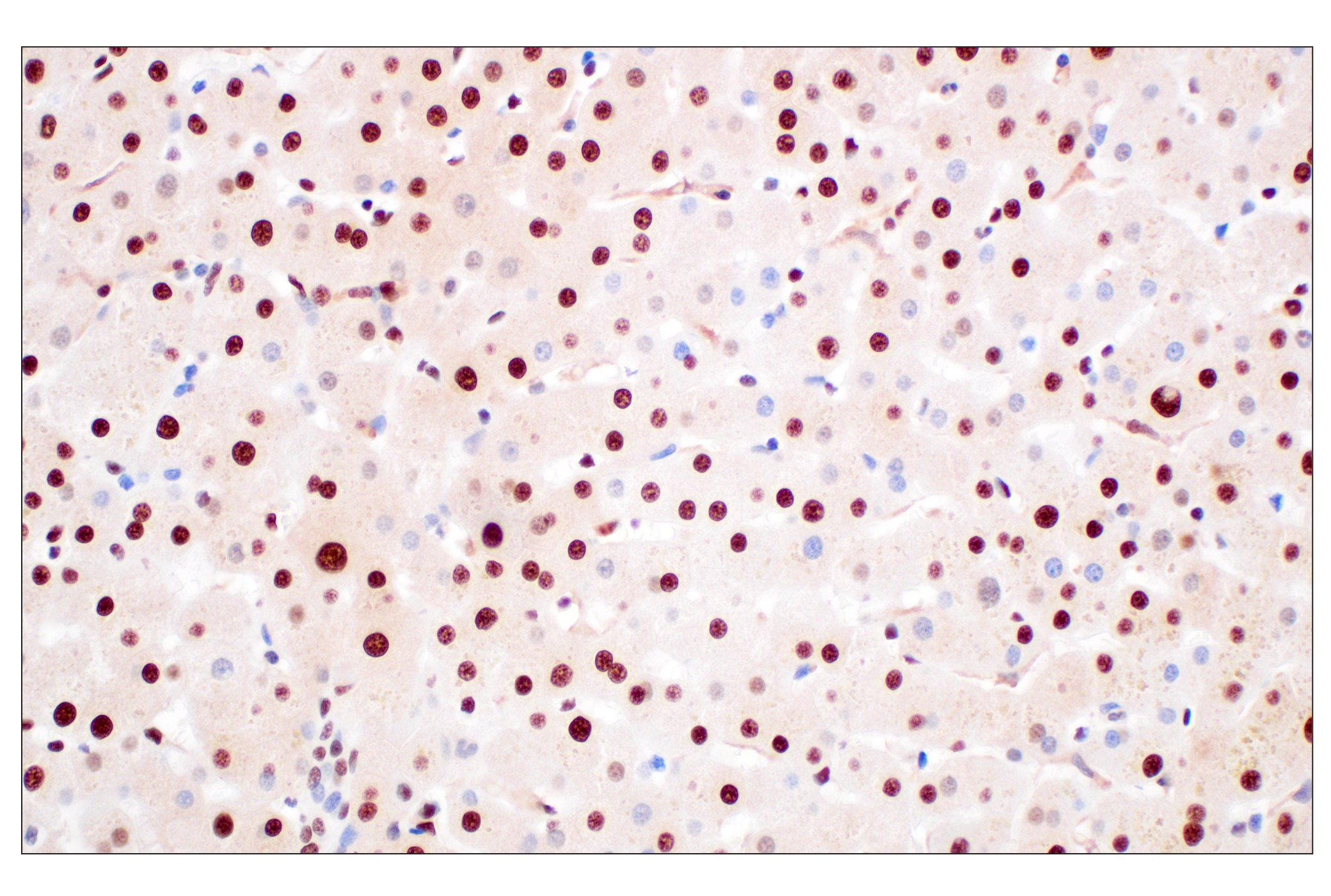Immunohistochemistry Image 5: FKBP5 (F1G3I) Rabbit mAb