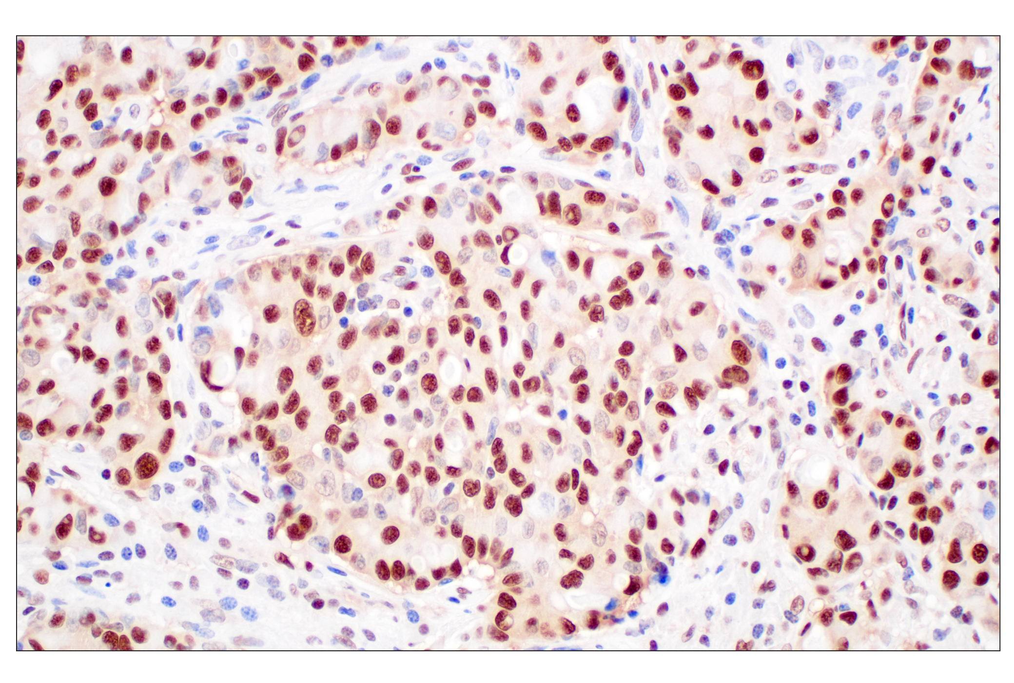 Immunohistochemistry Image 1: FKBP5 (F1G3I) Rabbit mAb