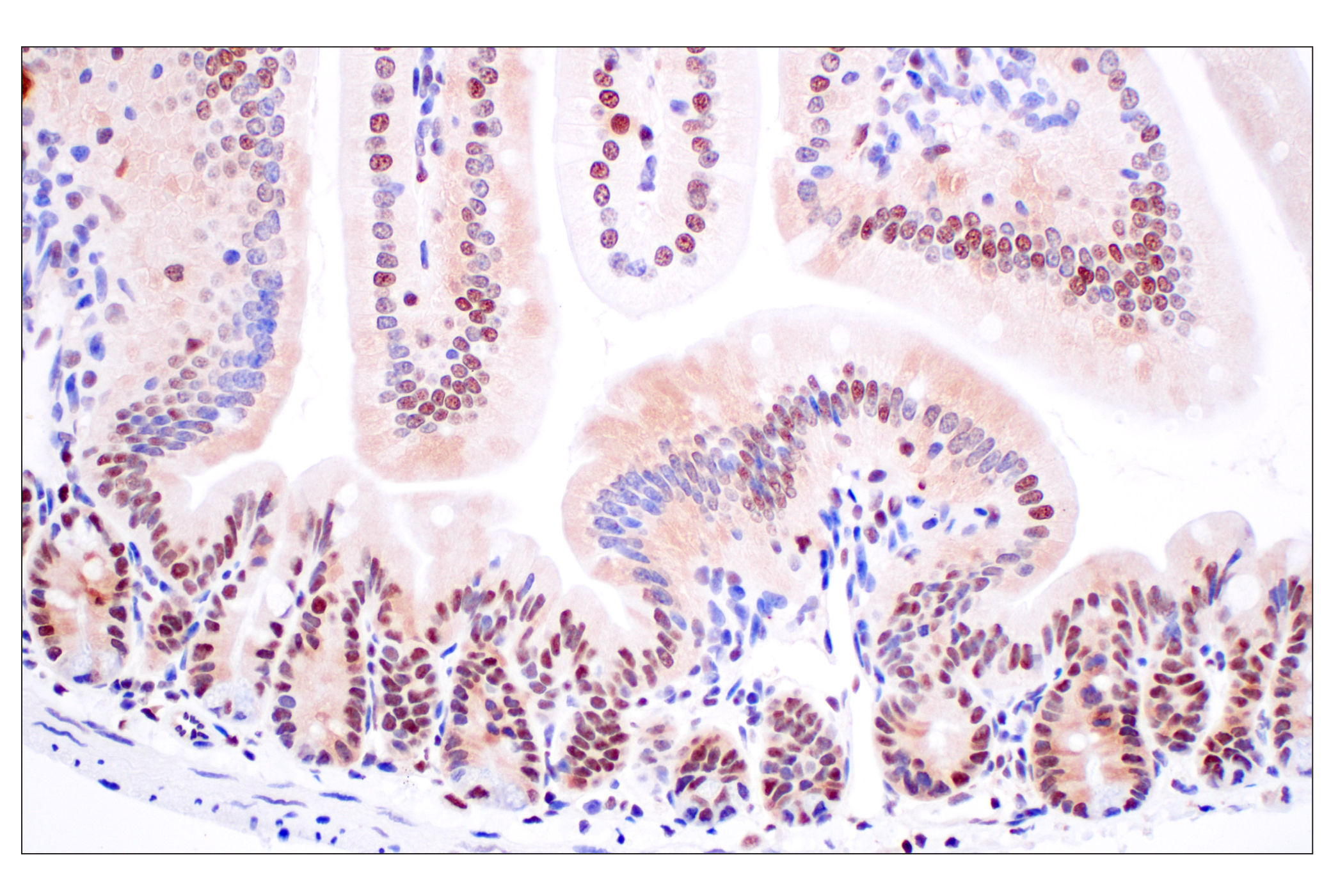 Immunohistochemistry Image 13: FKBP5 (F1G3I) Rabbit mAb