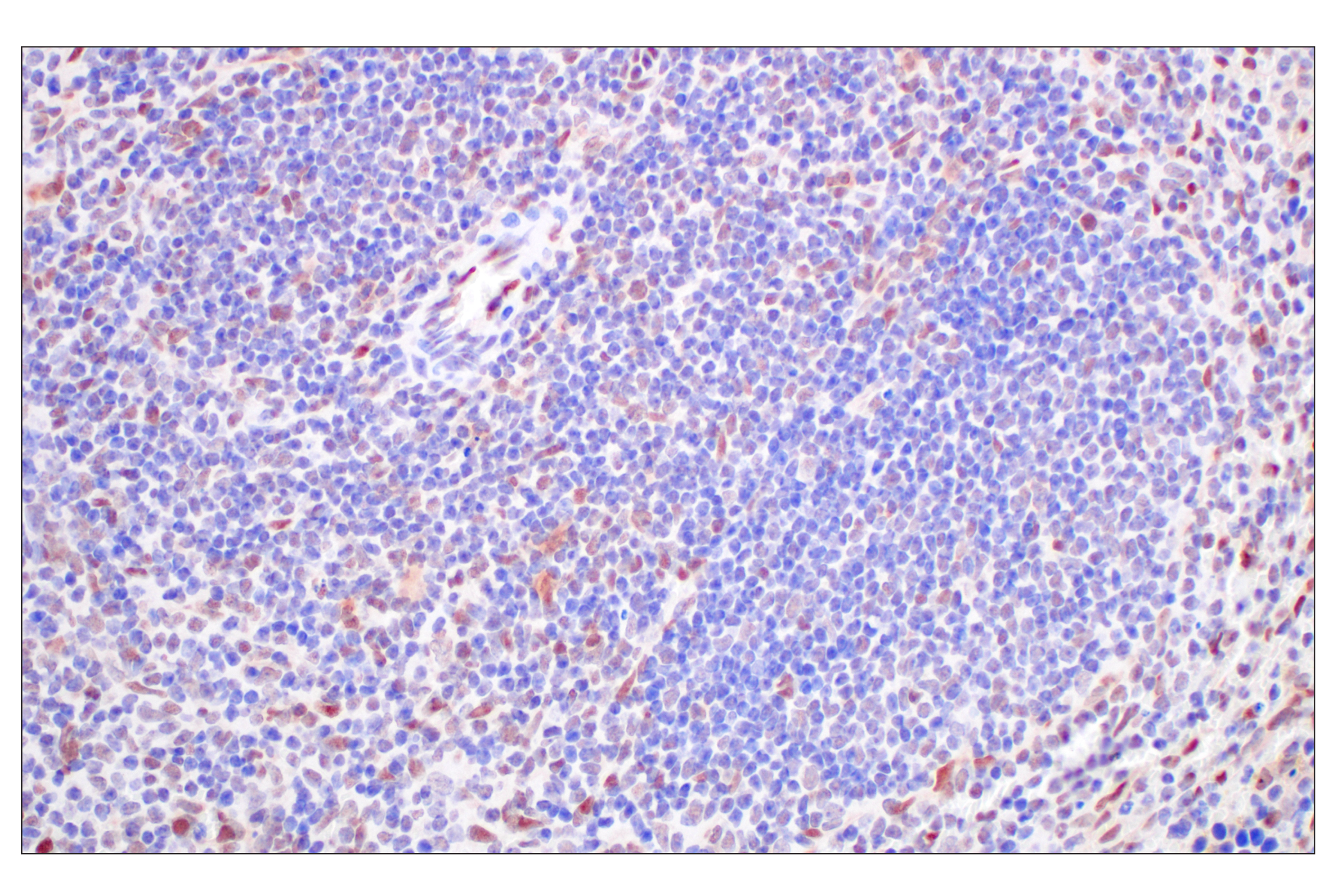 Immunohistochemistry Image 10: FKBP5 (F1G3I) Rabbit mAb