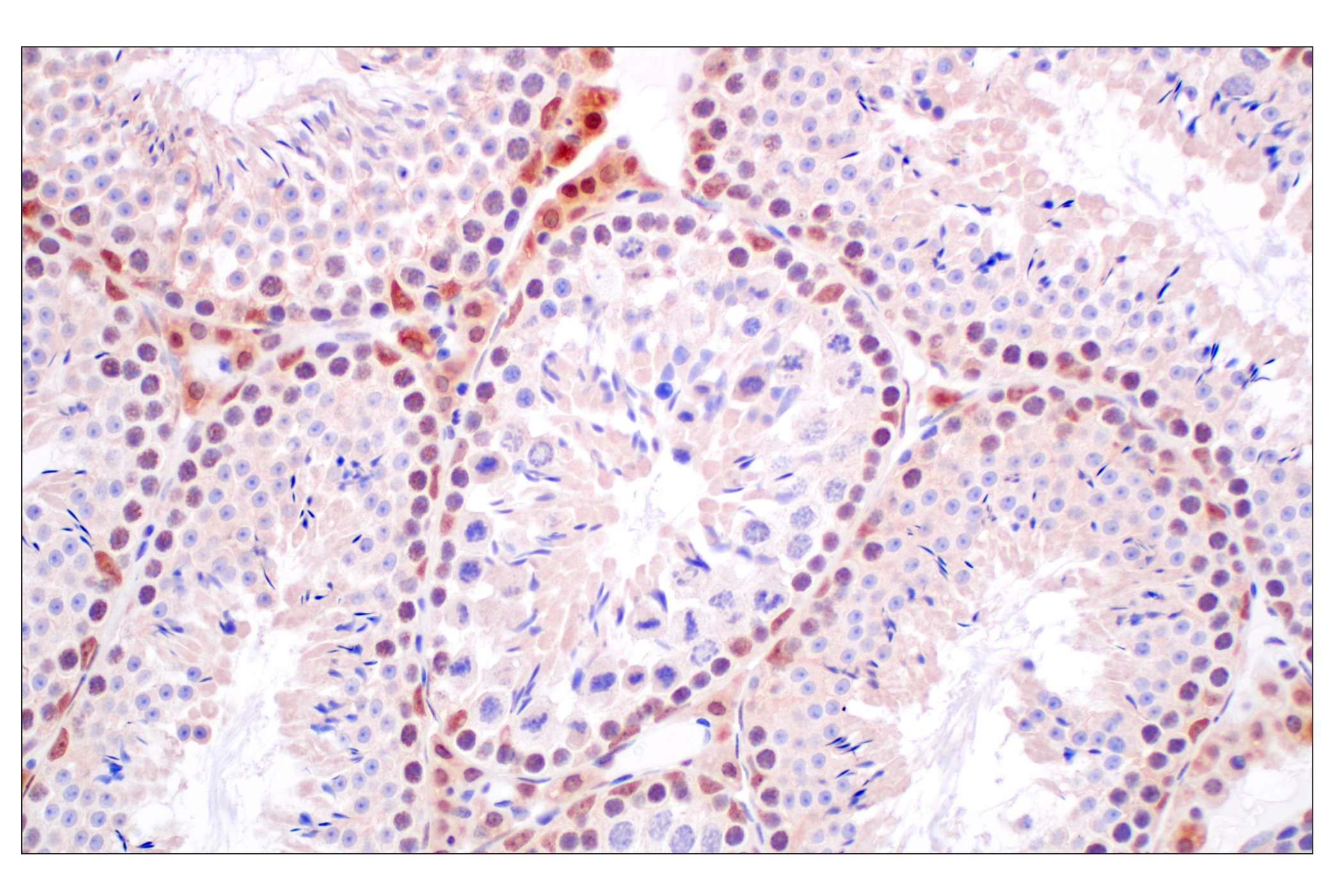 Immunohistochemistry Image 14: FKBP5 (F1G3I) Rabbit mAb
