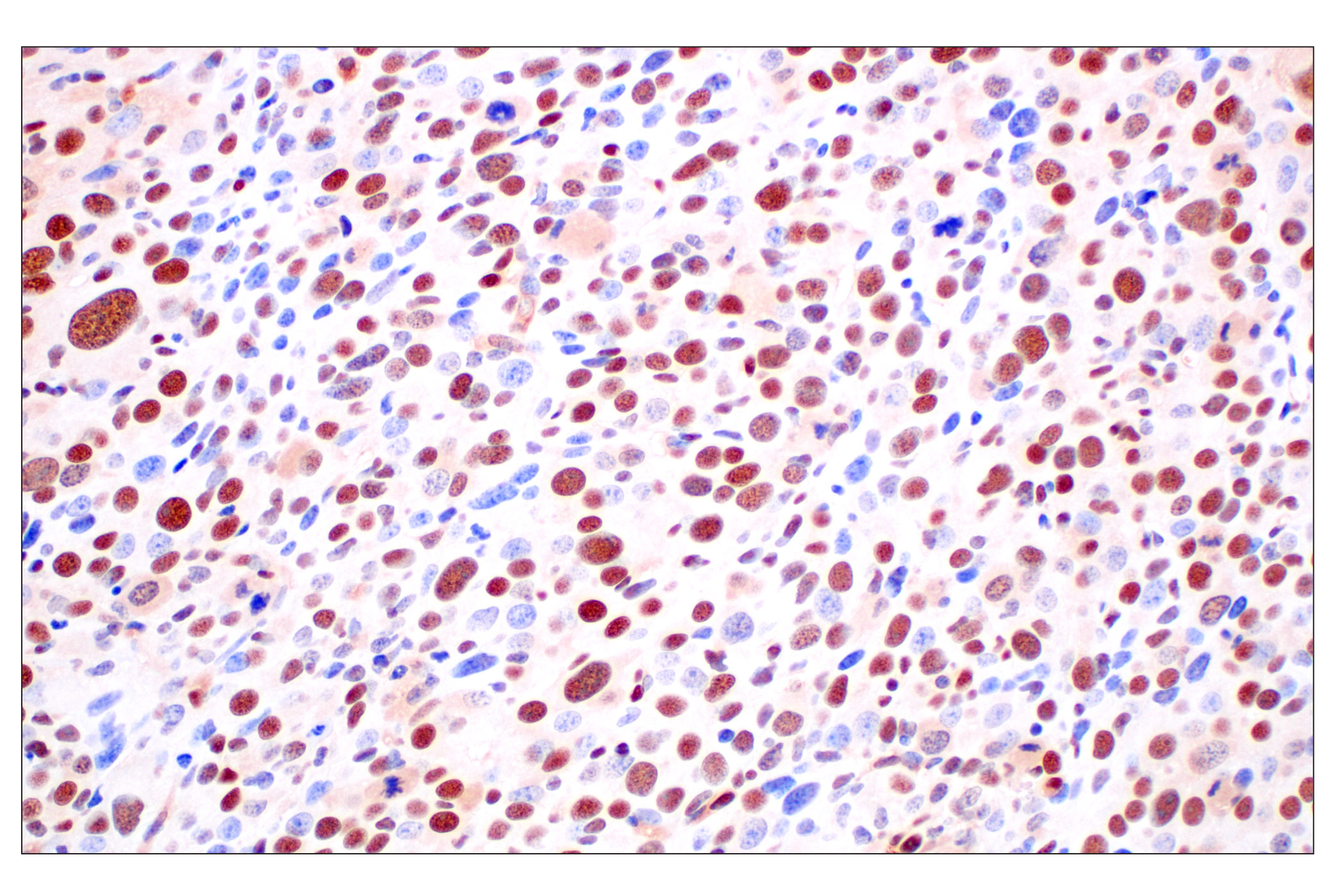 Immunohistochemistry Image 8: FKBP5 (F1G3I) Rabbit mAb