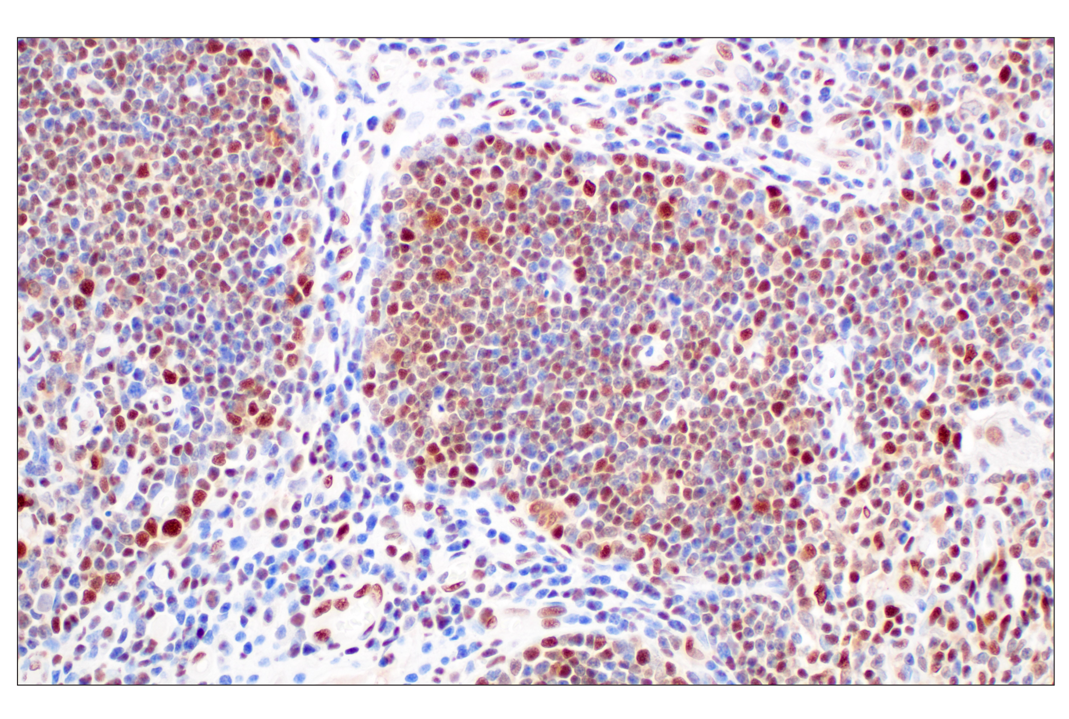 Immunohistochemistry Image 4: FKBP5 (F1G3I) Rabbit mAb