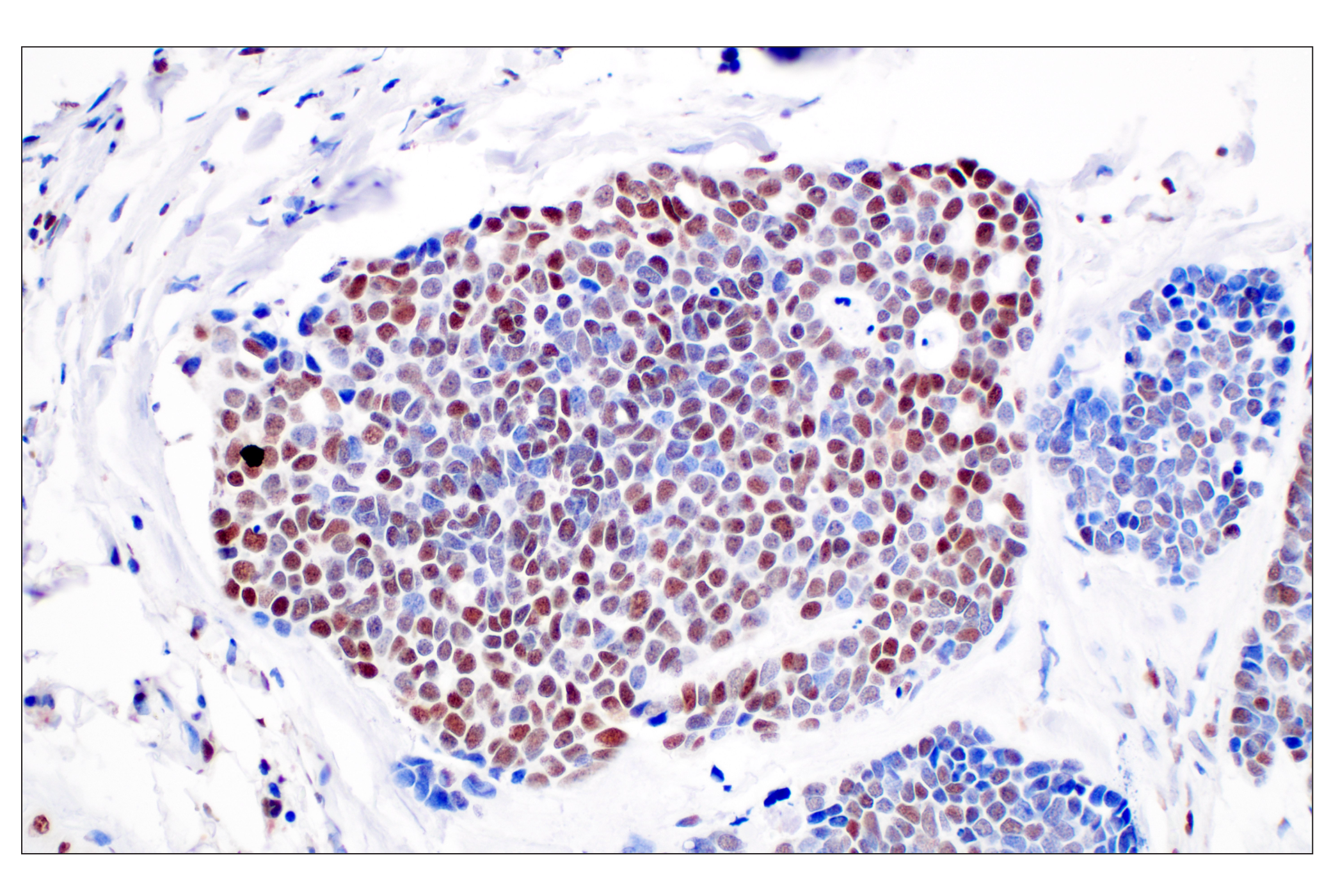 Immunohistochemistry Image 3: FKBP5 (F1G3I) Rabbit mAb