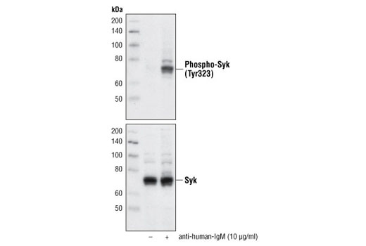 Western Blotting Image 2: Phospho-Syk (Tyr323) Antibody