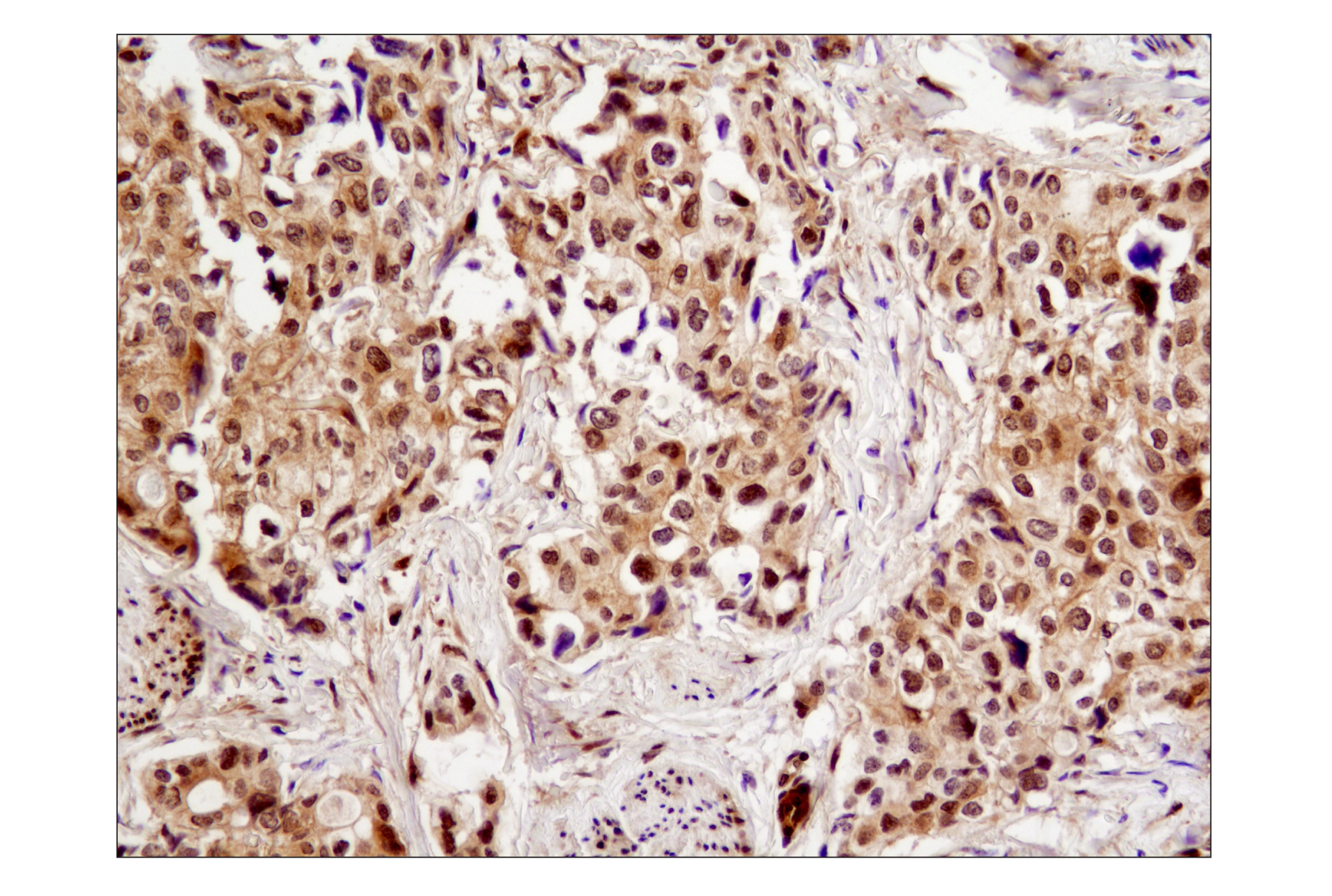 Immunohistochemistry Image 1: YAP (1A12) Mouse mAb (BSA and Azide Free)