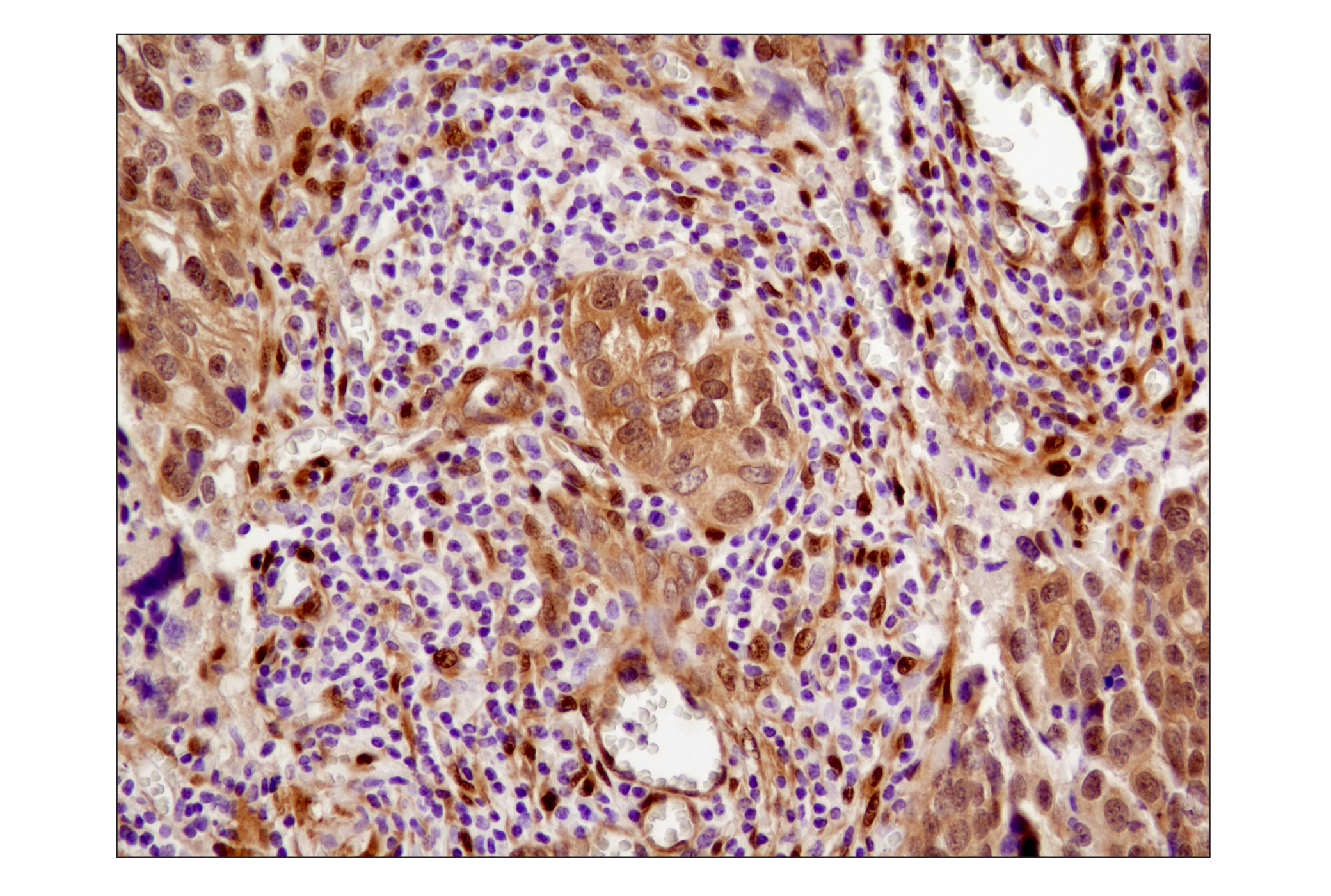 Immunohistochemistry Image 2: YAP (1A12) Mouse mAb (BSA and Azide Free)