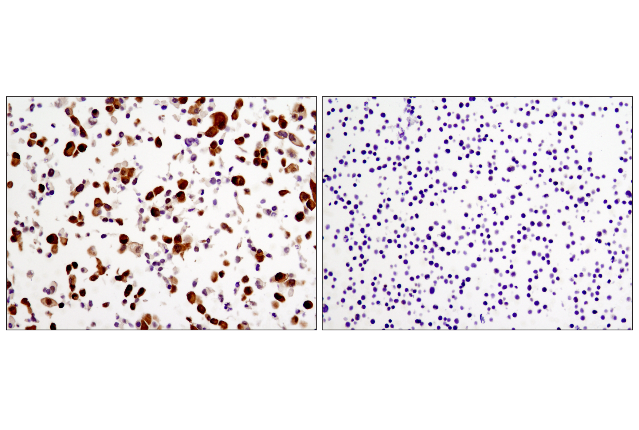 Immunohistochemistry Image 3: YAP (1A12) Mouse mAb (BSA and Azide Free)