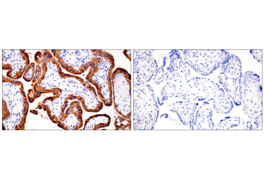 Immunohistochemistry Image 10: Pan-Keratin (5D3/LP34) Mouse mAb
