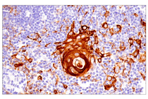 Immunohistochemistry Image 8: Pan-Keratin (5D3/LP34) Mouse mAb