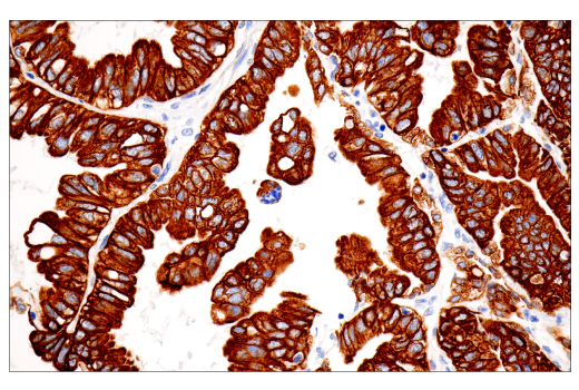Immunohistochemistry Image 4: Pan-Keratin (5D3/LP34) Mouse mAb