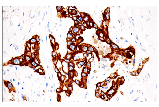 Immunohistochemistry Image 2: Pan-Keratin (5D3/LP34) Mouse mAb