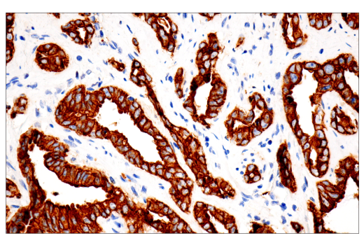 Immunohistochemistry Image 3: Pan-Keratin (5D3/LP34) Mouse mAb