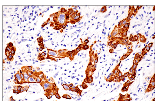 Immunohistochemistry Image 6: Pan-Keratin (5D3/LP34) Mouse mAb