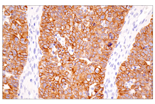 Immunohistochemistry Image 7: Pan-Keratin (5D3/LP34) Mouse mAb