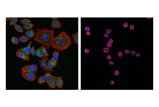 Immunofluorescence Image 1: β-Galactosidase (E2U2I) Rabbit mAb