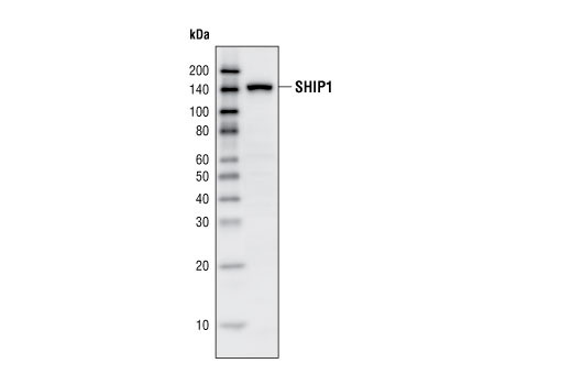 Western Blotting Image 1: SHIP1 (P290) Antibody