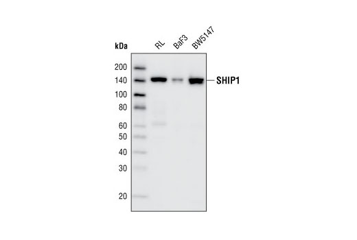 Western Blotting Image 1: SHIP1 (D1163) Antibody
