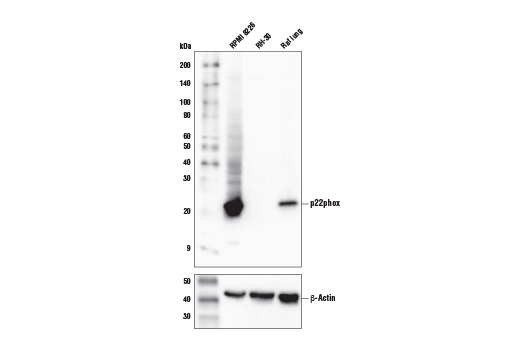 Western Blotting Image 1: p22phox Antibody