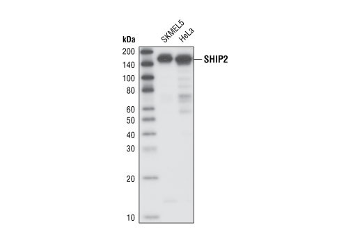 Western Blotting Image 1: SHIP2 Antibody