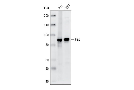 Western Blotting Image 1: Fes Antibody