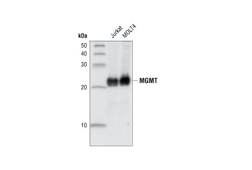 Western Blotting Image 1: MGMT Antibody
