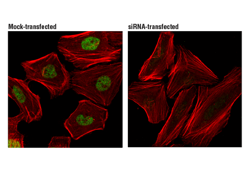Immunofluorescence Image 1: LRF/Pokemon (D7U2O) Rabbit mAb (BSA and Azide Free)