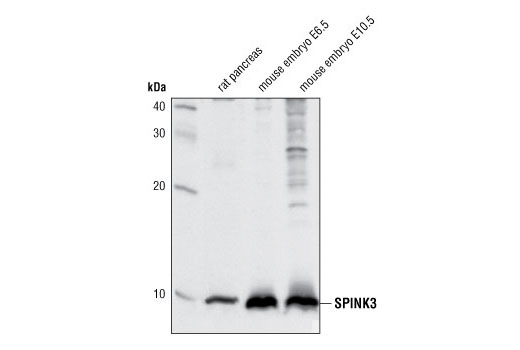 Western Blotting Image 1: SPINK3 Antibody