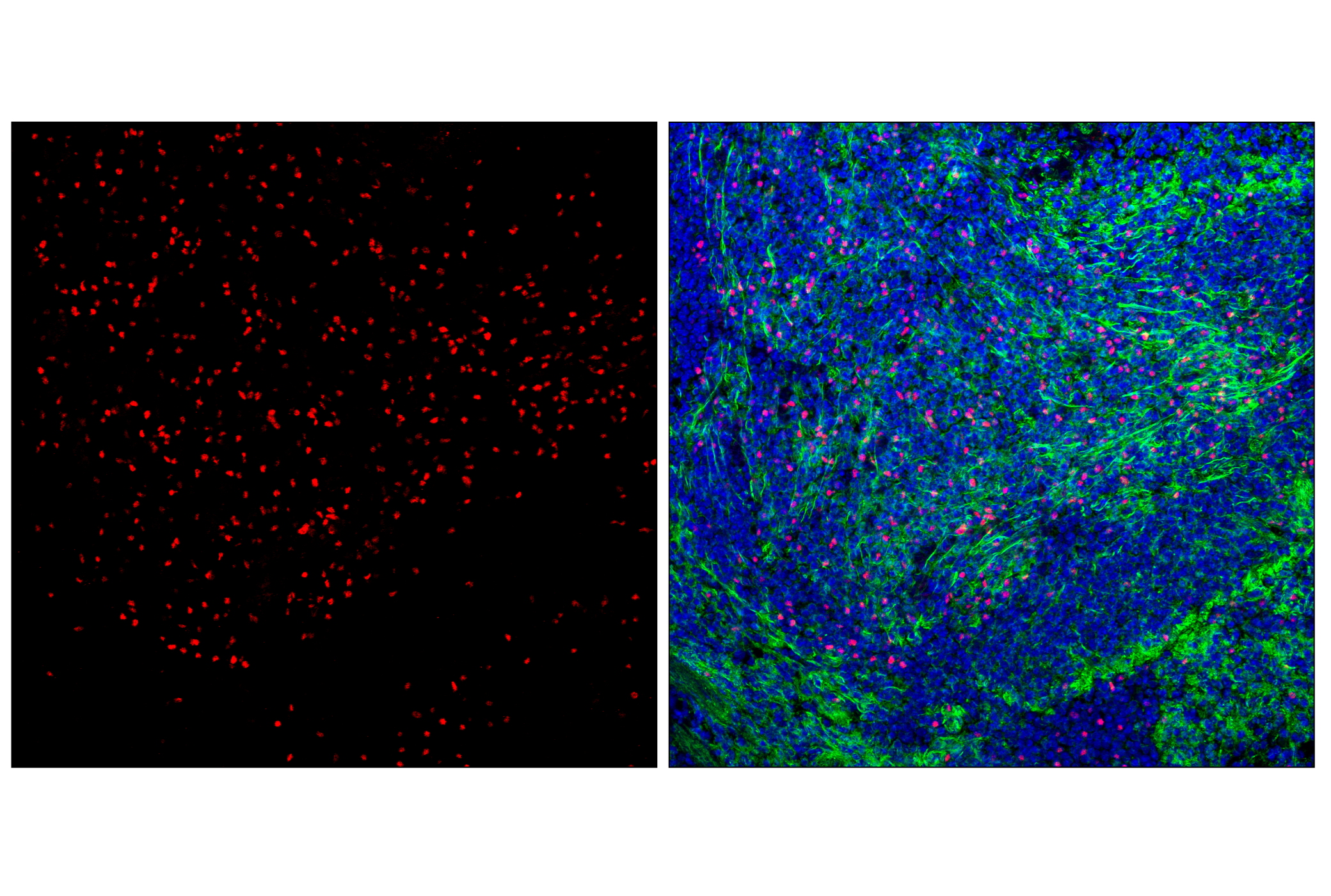 Immunofluorescence Image 1: FoxP3 (D6O8R) Rabbit mAb (Alexa Fluor® 555 Conjugate)