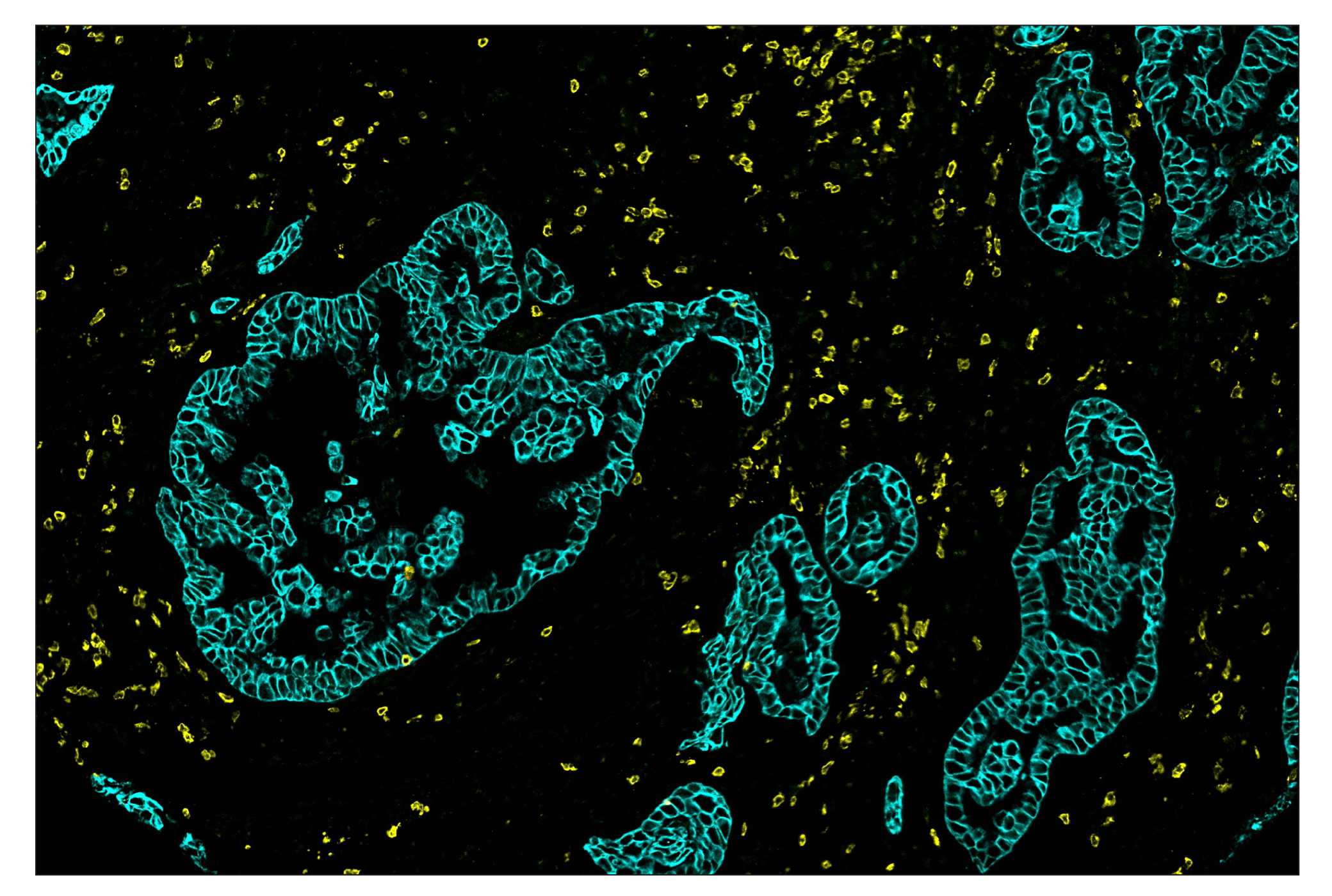 Immunohistochemistry Image 8: CD3ε (D7A6E™) & CO-0001-647 SignalStar™ Oligo-Antibody Pair