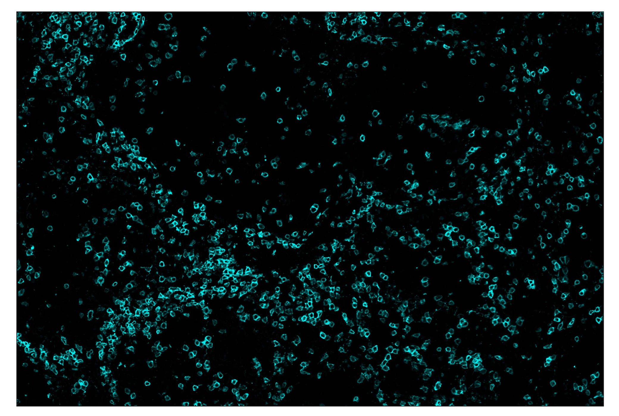 Immunohistochemistry Image 5: CD3ε (D7A6E™) & CO-0001-594 SignalStar™ Oligo-Antibody Pair