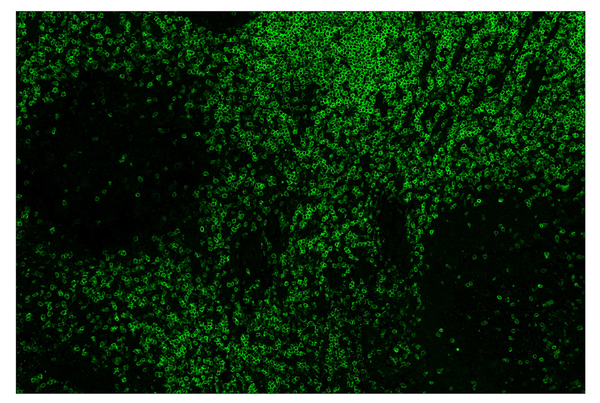 Immunohistochemistry Image 2: CD3ε (D7A6E™) & CO-0001-488 SignalStar™ Oligo-Antibody Pair