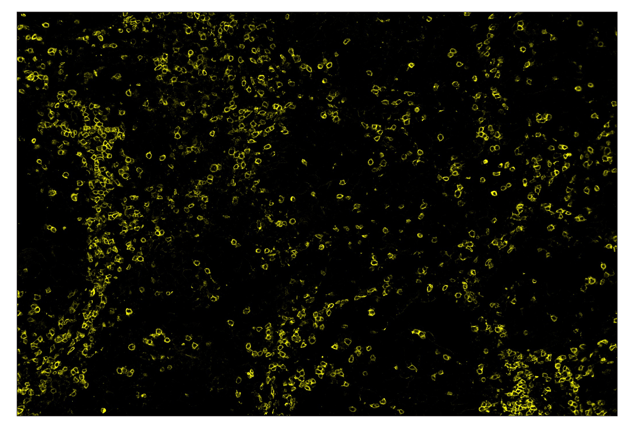 Immunohistochemistry Image 3: CD3ε (D7A6E™) & CO-0001-594 SignalStar™ Oligo-Antibody Pair